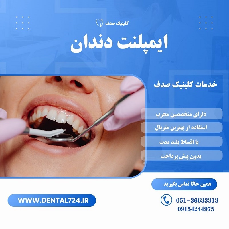 ایمپلنت دندان با کیفیت و عمر طولانی در مشهد عکس شماره 1