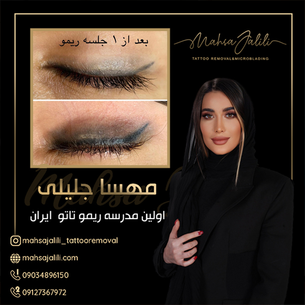 آموزش ریموو تاتو خط چشم با بروزترین تکنیک عکس شماره 5
