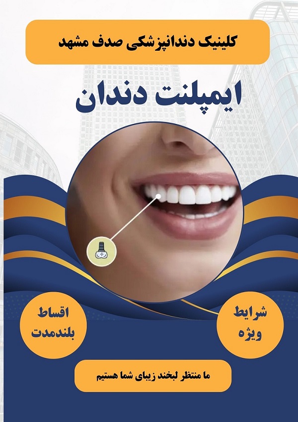 ایمپلنت دندان در مشهد با اقساط بلند مدت، بدون پیش پرداخت ( دیگه نگران هزینه‌ها نباش )