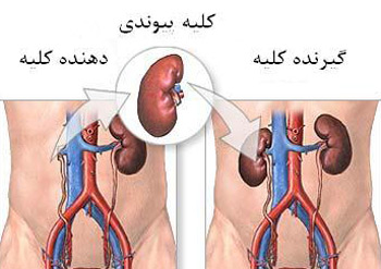 فروش فوری کلیه فوری