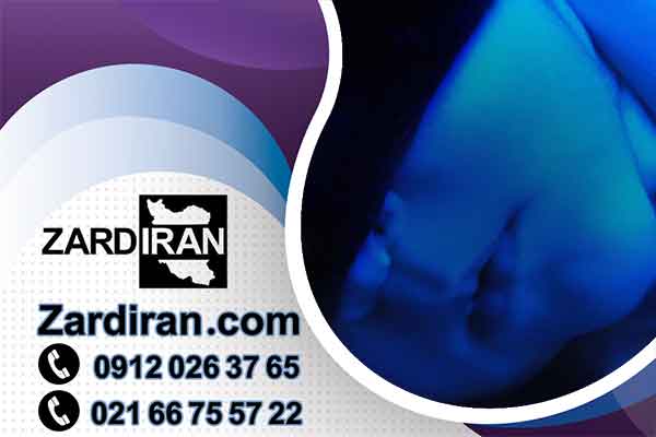 اجاره دستگاه زردی نوزاد و فتوتراپی در اندیشه شهریار عکس شماره 3