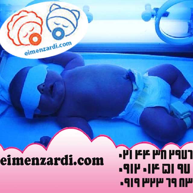 فروش دستگاه زردی نوزاد و فتوتراپی شرکت ایمن زردی عکس شماره 2