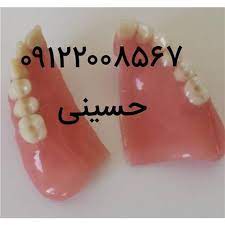 تعمیر دندان مصنوعی شکسته عکس شماره 3