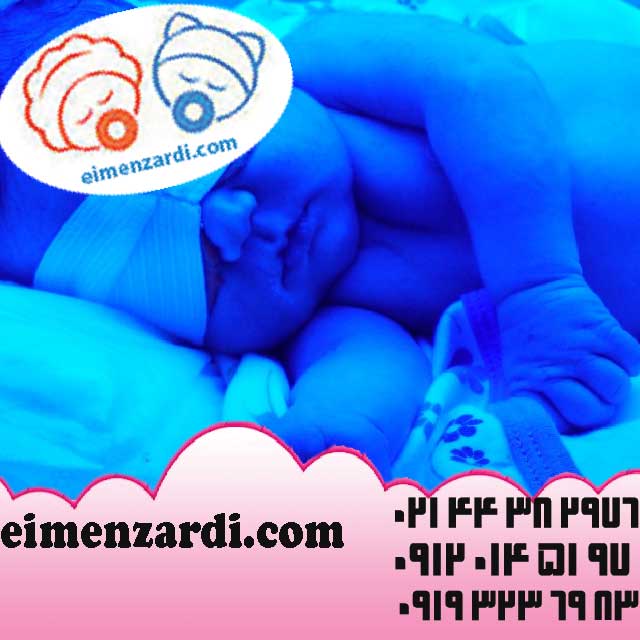 فروش دستگاه زردی نوزاد و فتوتراپی شرکت ایمن زردی عکس شماره 3