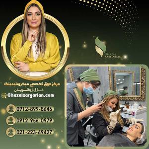 بهترین مرکز میکروبلیدینگ در تهران و ایران