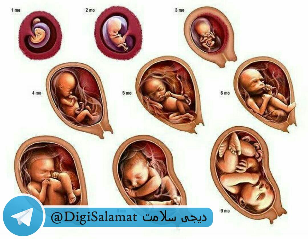 نیازمند رحم اجاره