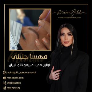 مدرسه تخصصی ریموو تاتو در تهران 