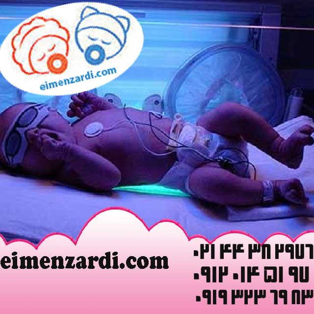 فروش دستگاه زردی نوزاد و فتوتراپی شرکت ایمن زردی