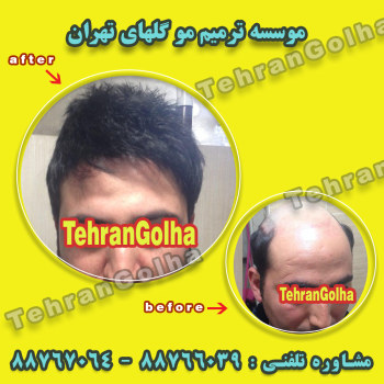 ترمیم موی در موسسه گلهای تهران