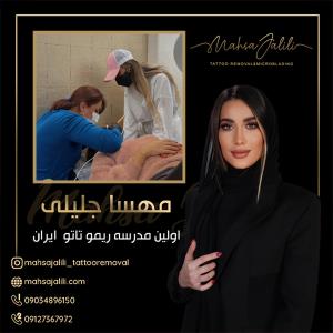 آموزش ریموو تاتو خط چشم با بروزترین تکنیک