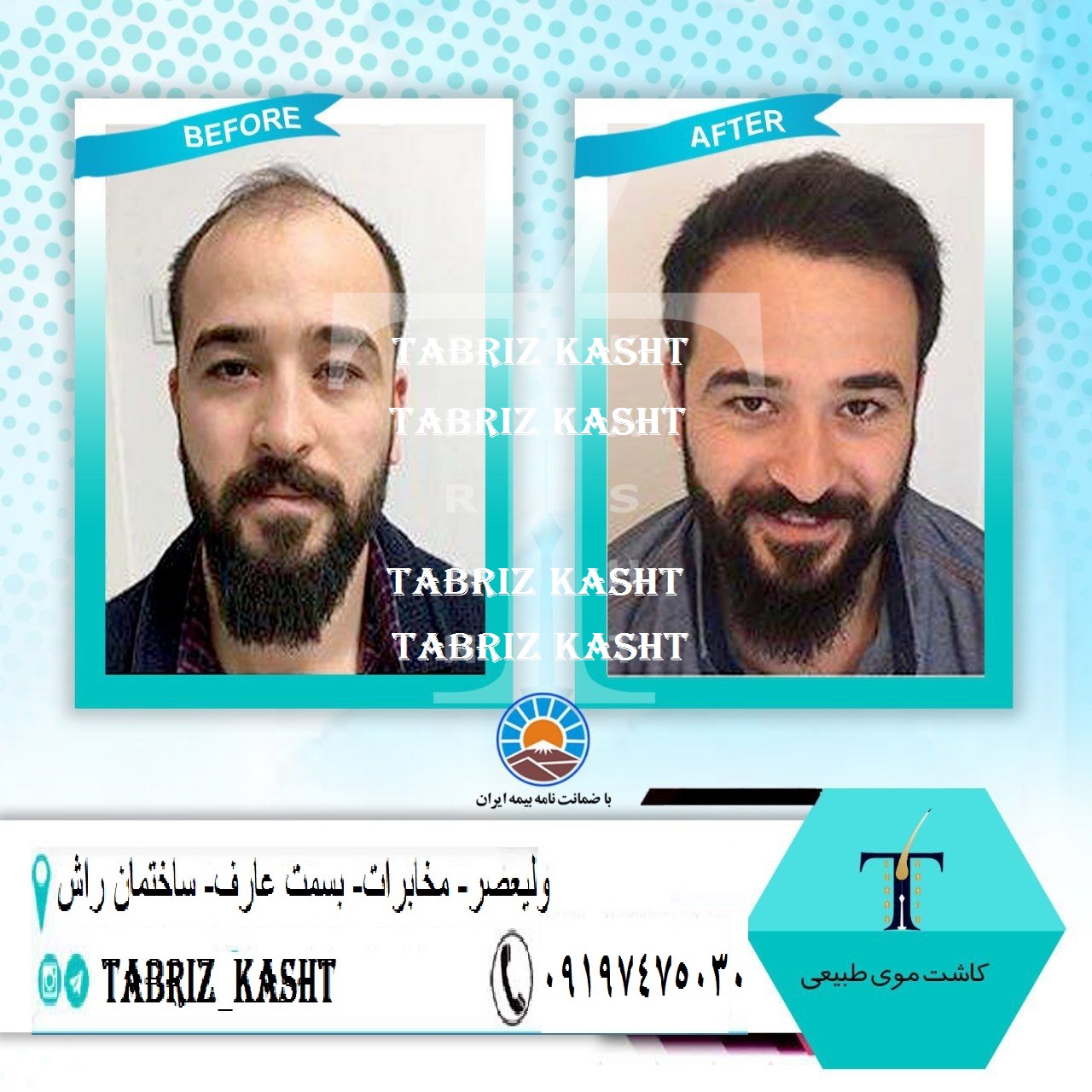 تبریز کاشت