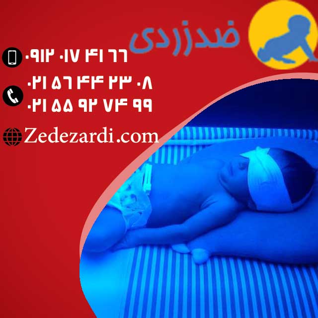 کمترین اجاره دستگاه زردی نوزاد در منزل با چشم بند ضد زردی