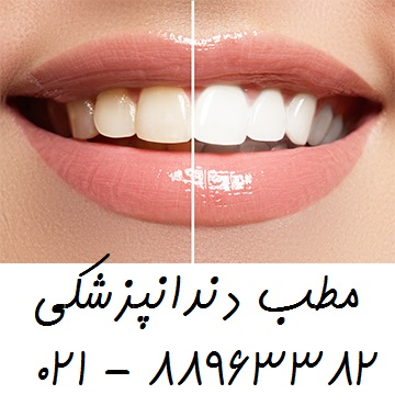 بهترین متخصص جراحی لثه جراحی دندان عقل   