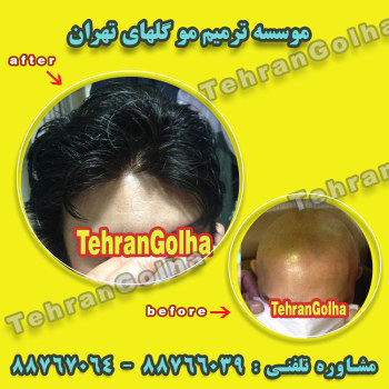ترمیم موی در موسسه گلهای تهران
