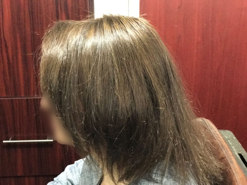 کلينيک تخصصي بهترين مو با جديد ترين روش ترميم مو