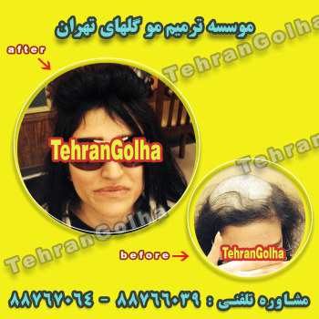 ترمیم موی در موسسه گلهای تهران