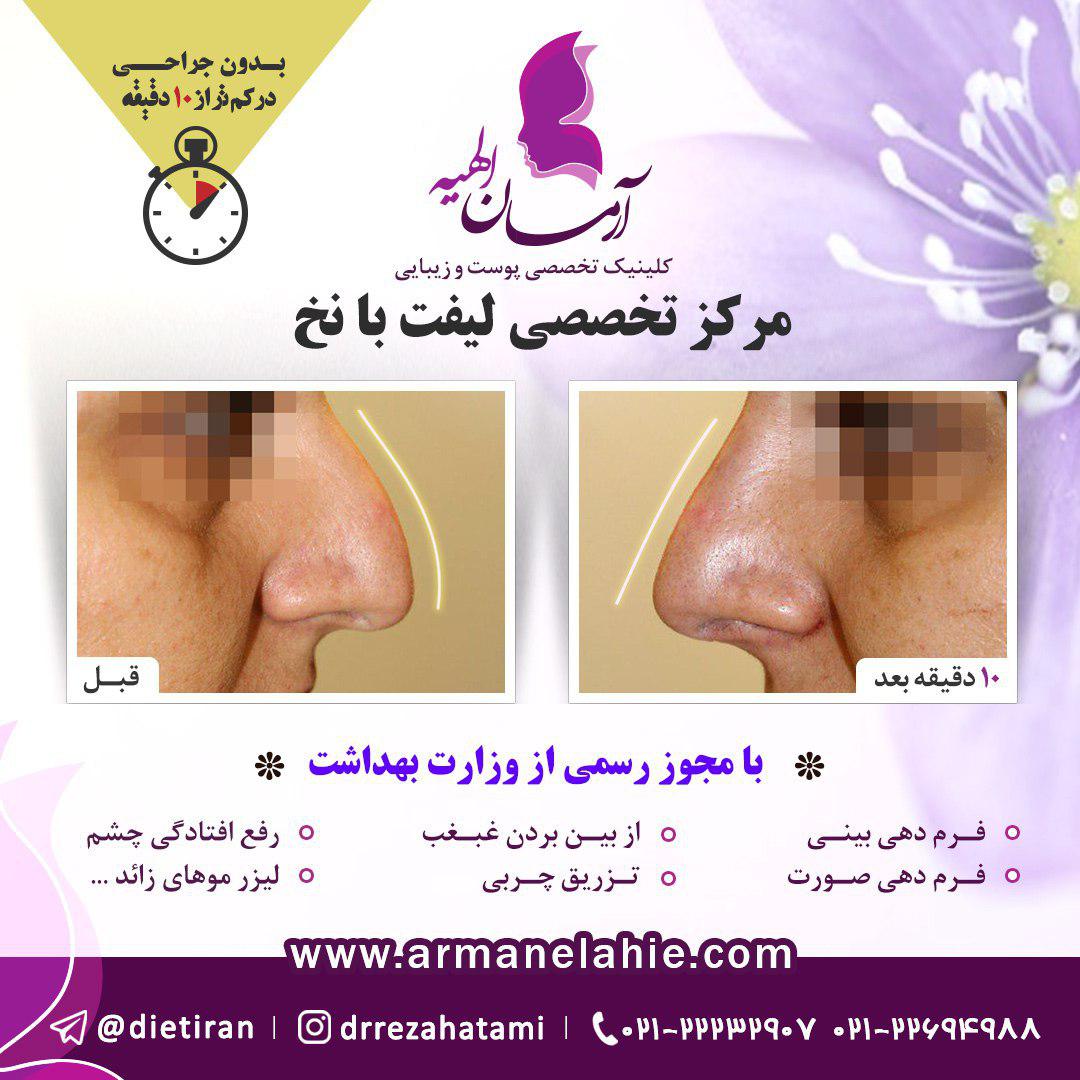 کلینیک زیبایی و لاغری آرمان الهیه