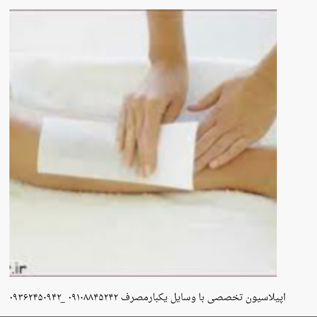 اپیلاسیون