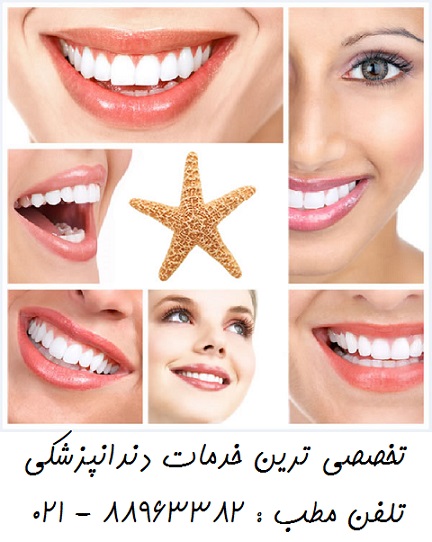 بهترین متخصص لمینیت میدان ولیعصر    