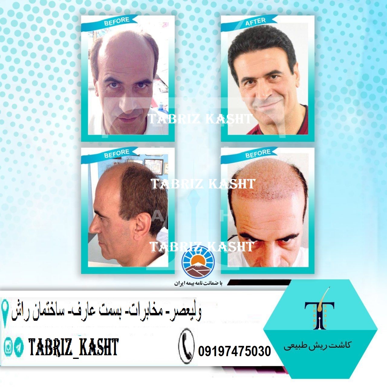 تبریز کاشت