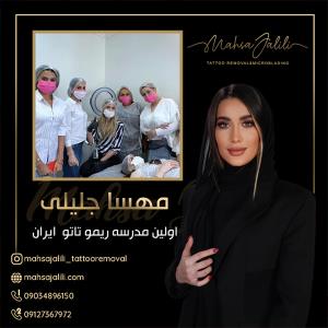 آموزش ریموو تاتو خط چشم با بروزترین تکنیک